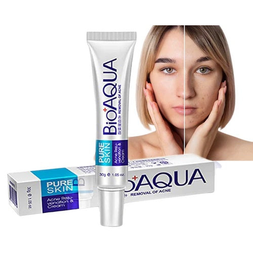 Set Anti-Acné Bioaqua